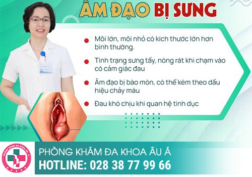 Vùng kín bị sưng 1 bên mép là bệnh gì?