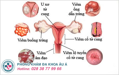 Hết kinh lại ra máu có sao không?