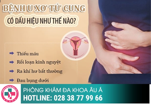 Rối loạn kinh nguyệt 1 tháng có 2 lần là bệnh gì? 