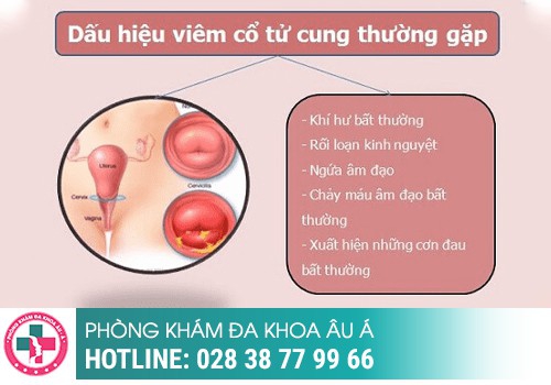 KHÍ HƯ ĐẶC, KHÍ HƯ VÓN CỤC LÀ DẤU HIỆU BỆNH GÌ?