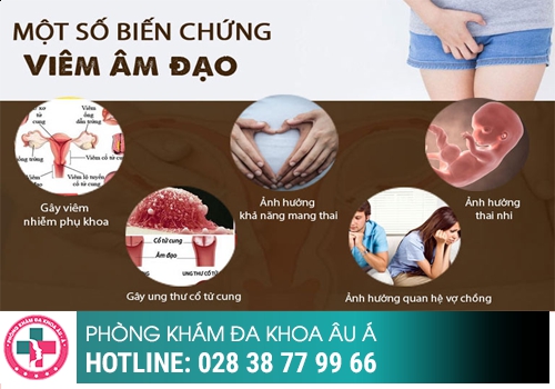 viêm âm đạo