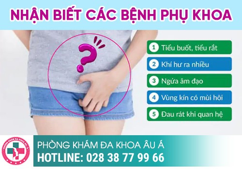 Kiến thức cơ bản về bệnh phụ khoa