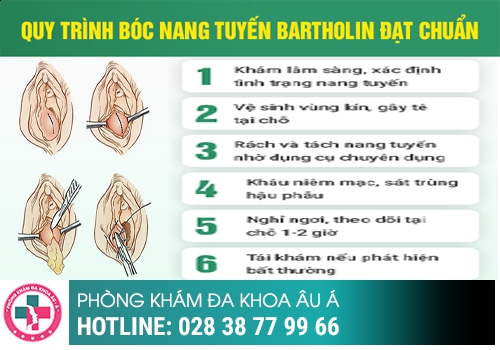 Bị nổi mụn ở môi lớn và môi bé âm đạo điều trị hiệu quả như thế nào?