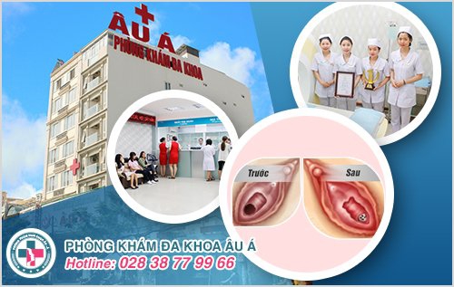 âm đạo rộng