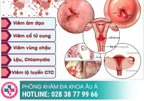 Bệnh phụ khoa nguy hiểm cần can thiệp gấp