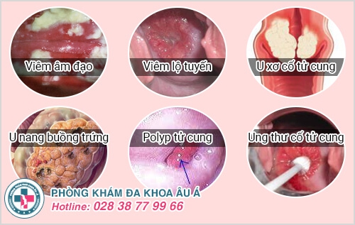 khám phụ khoa định kỳ
