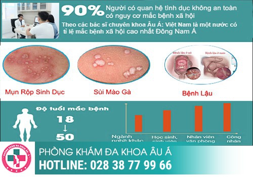 Các bệnh lây qua đường tình dục