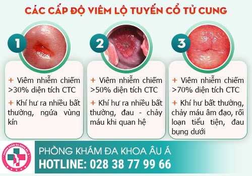 KHÍ HƯ MÀU VÀNG LÀ DẤU HIỆU BỆNH GÌ?