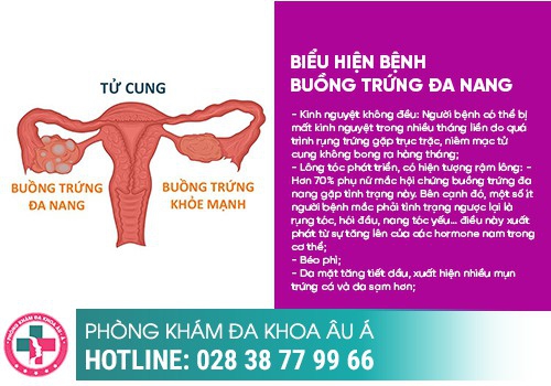 Rối loạn kinh nguyệt 1 tháng có 2 lần là bệnh gì? 