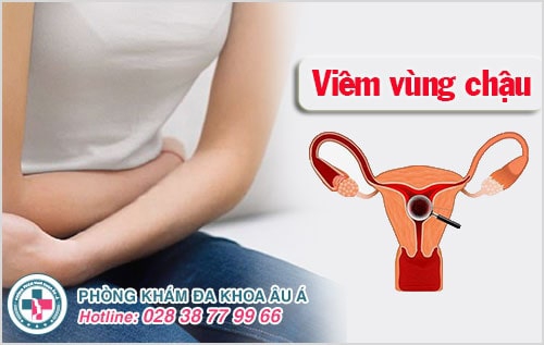 đau bụng dưới