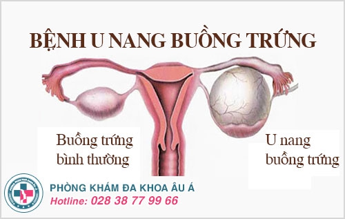 đau rát khi quan hệ