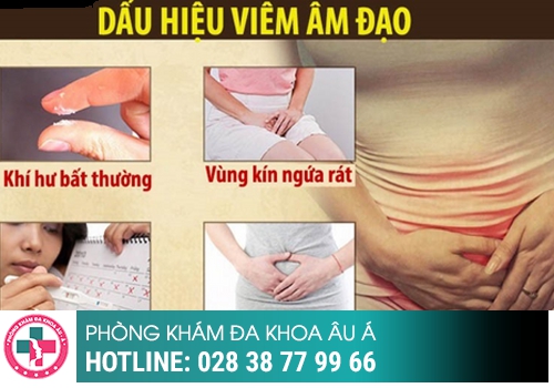 Huyết trắng màu nâu là bị gì?