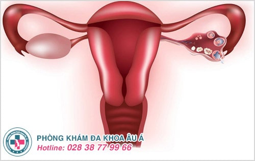 Tất tần tật những kiến thức mà chị em nên biết về bệnh phụ khoa