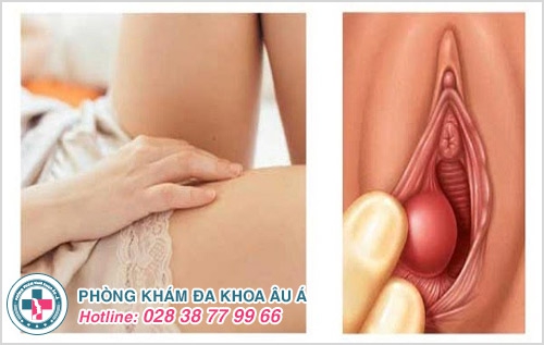 cô bé bị sưng sau khi quan hệ