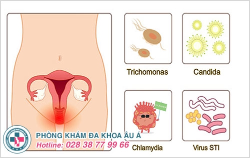 Huyết trắng có màu vàng