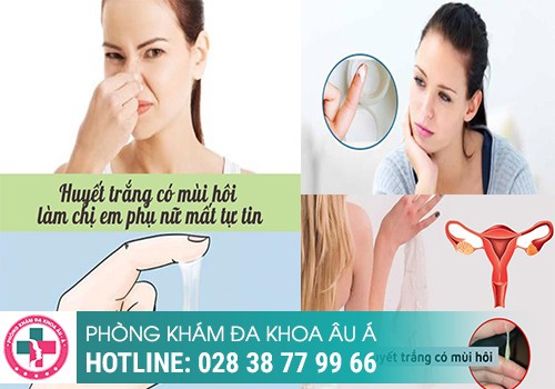 NGUYÊN NHÂN KHIẾN HUYẾT TRẮNG CÓ MÙI LẠ