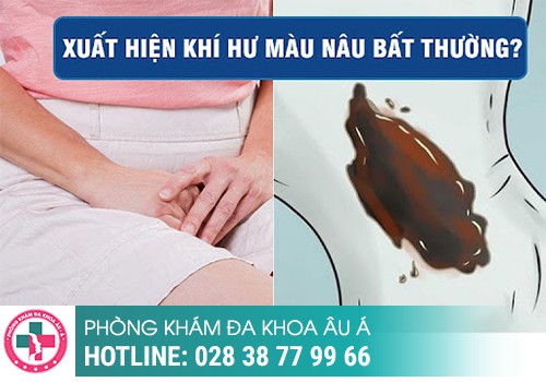Chậm kinh ra máu màu nâu có nguy hiểm không?