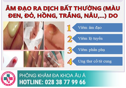 KHÍ HƯ CÓ MÀU BẤT THƯỜNG 