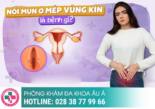 Nguyên nhân mọc mụn ở âm đạo