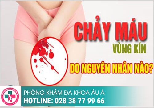 NGUYÊN NHÂN CHẢY MÁU ÂM ĐẠO LÀ GÌ?