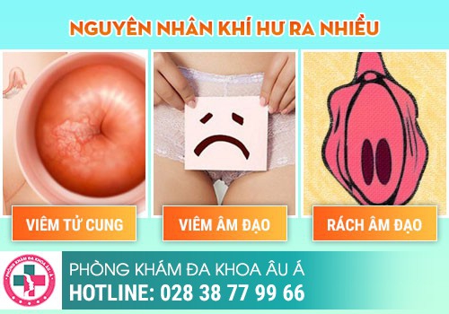 Ra khí hư nhiều - dấu hiệu của nhiễm trùng?