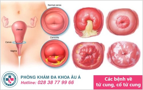 Thông tin xung quanh tình trạng kinh nguyệt có mùi hôi tanh