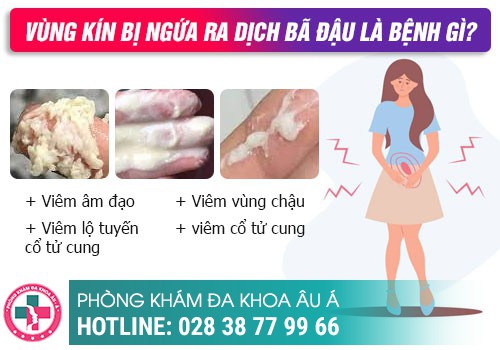 Nguyên nhân bị ngứa 2 bên mép vùng kín