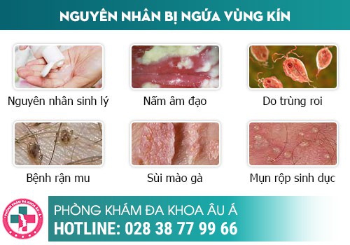 TẠI SAO CHỊ EM PHỤ NỮ QUAN HỆ BỊ NGỨA?