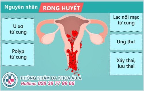 Chị em cần hiểu đúng về hiện tượng rong huyết