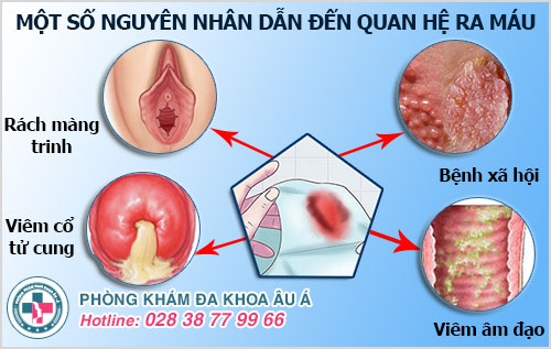 Quan hệ ra máu do bệnh gì gây nên? Có nguy hiểm không?