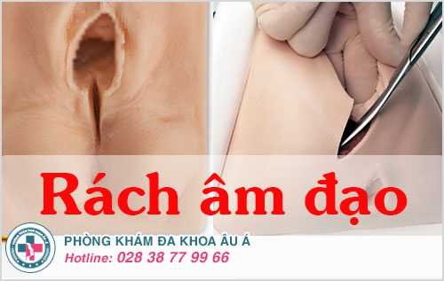 Rách âm đạo, nguyên nhân do đâu?
