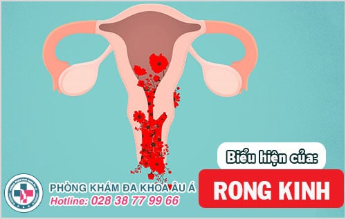 rong kinh