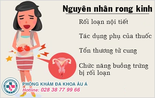 rong kinh