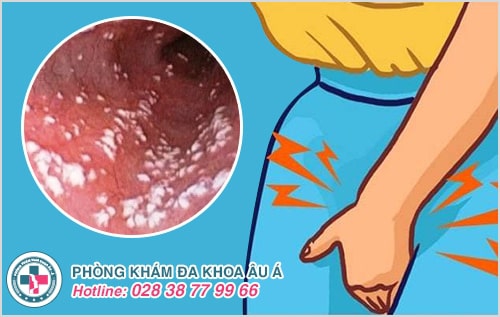 Tổng hợp những bệnh phụ khoa thường gặp ở nữ giới