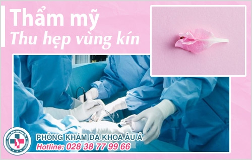 thẩm mỹ vùng kín