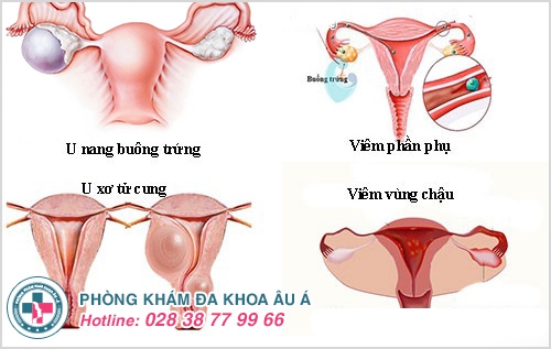 Trung tâm tư vấn phụ khoa 