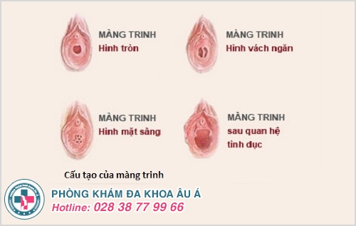 Vá màng trinh và những điều cần biết