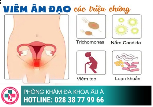 Dấu hiệu viêm nhiễm phụ khoa