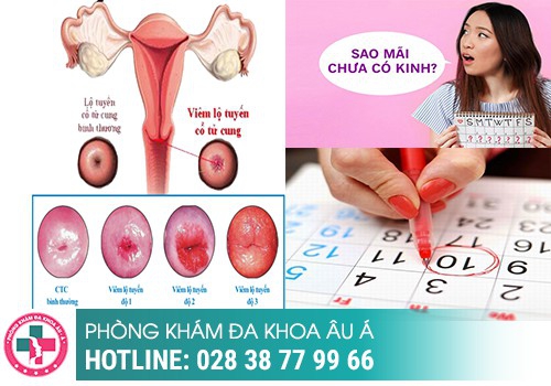 Chậm kinh 10 ngày thử que 1 vạch nguyên nhân do đâu?