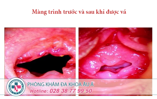 Bệnh viện phụ khoa TPHCM