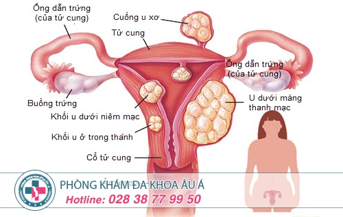 Dấu hiệu hiếm muộn ở nữ