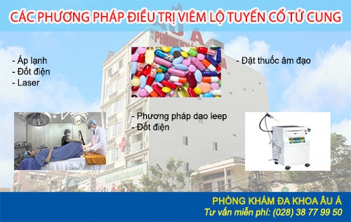 Nguyên nhân - dấu hiệu viêm lộ tuyến cổ tử cung