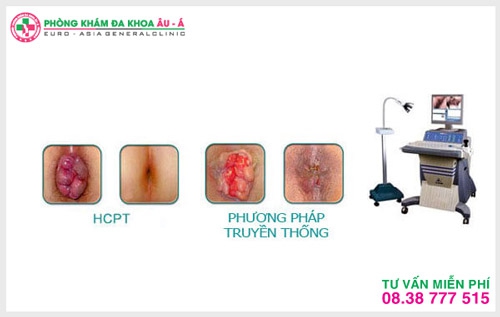 hỗ trợ điều trị trĩ ngoại hiệu quả  ở đâu tại TPHCM