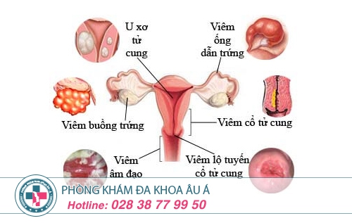 Phòng khám phụ khoa tốt nhất TPHCM
